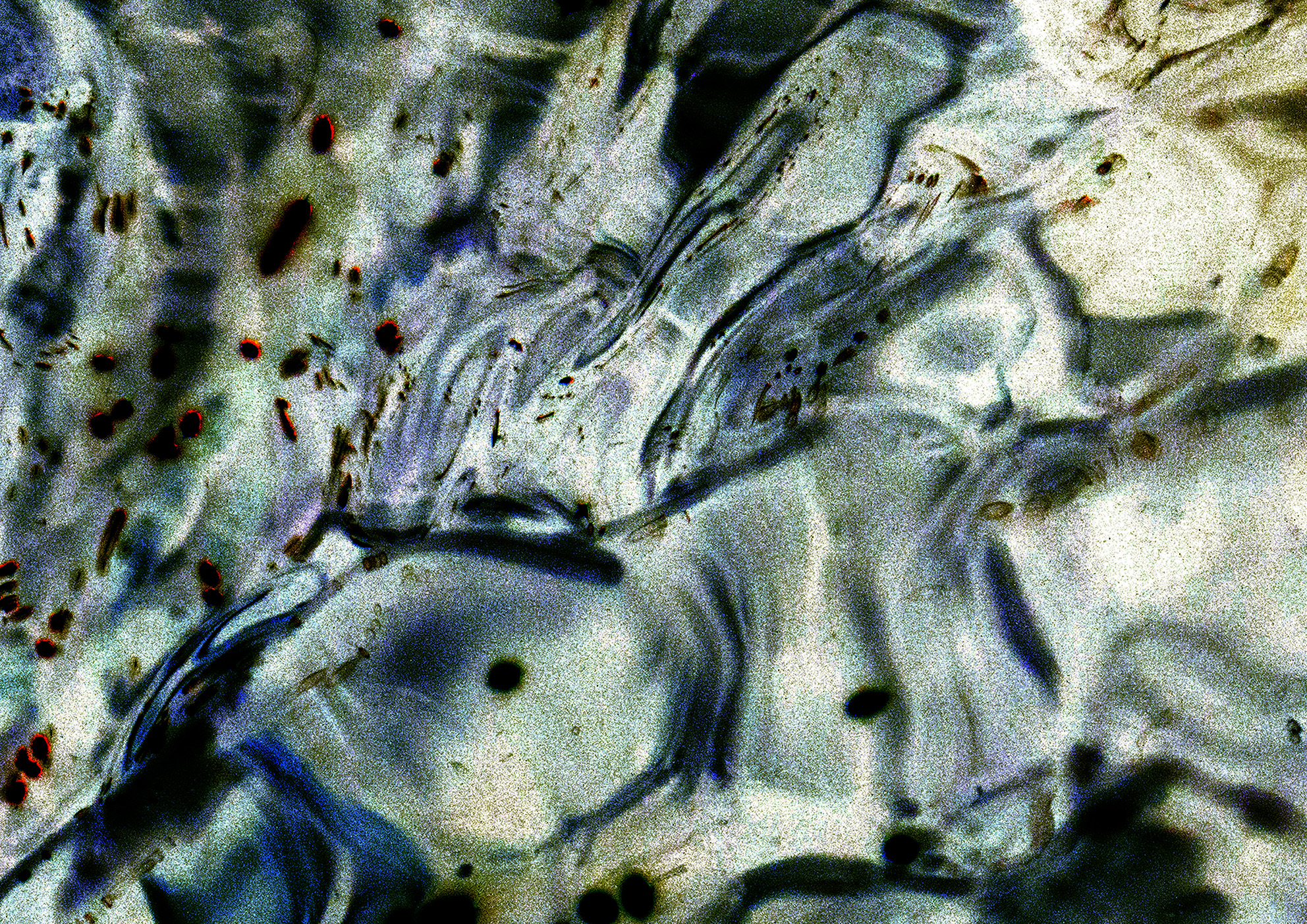 11A