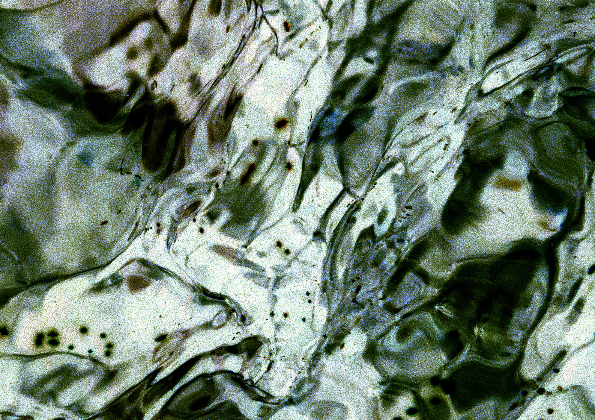 14a