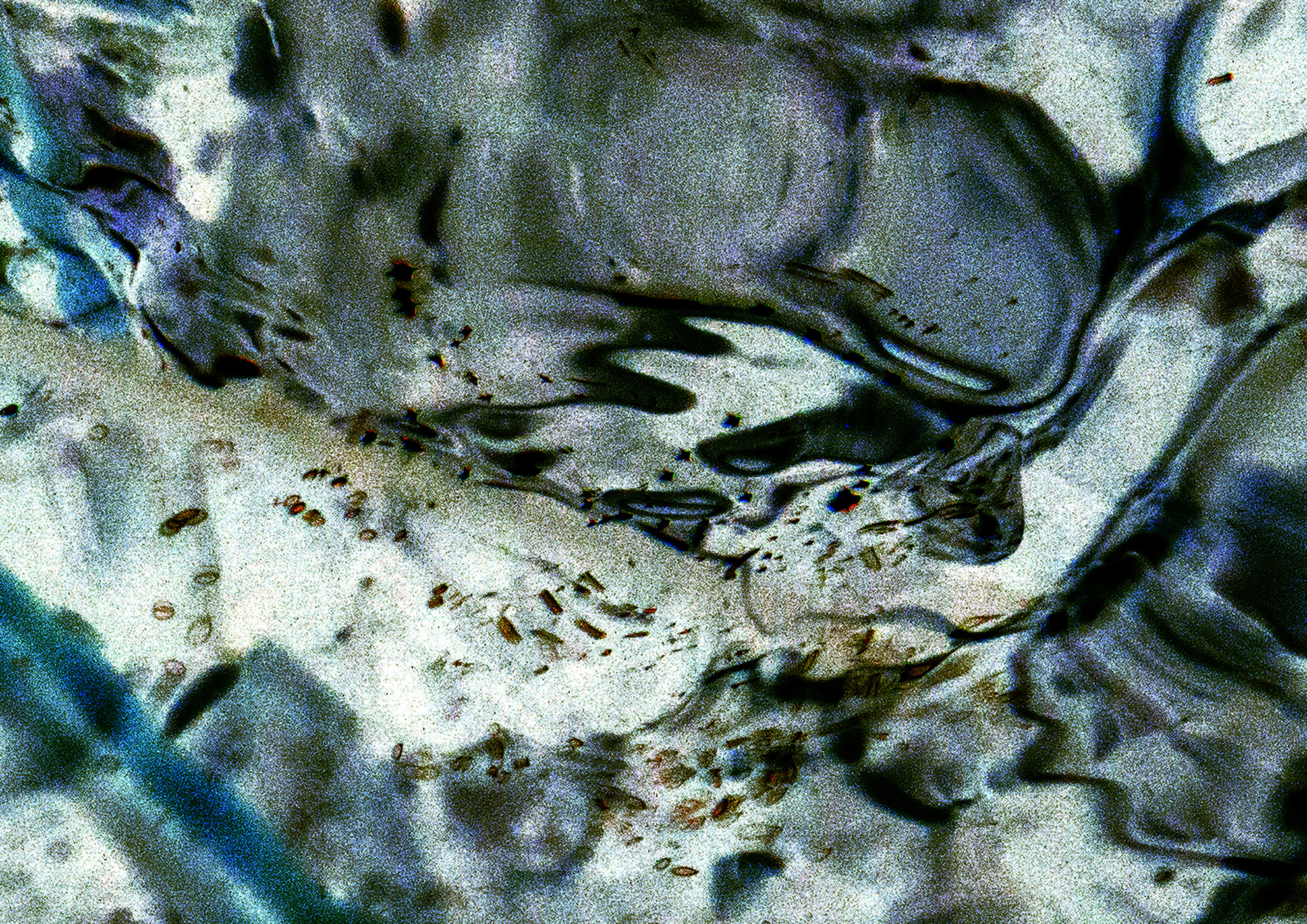 20A