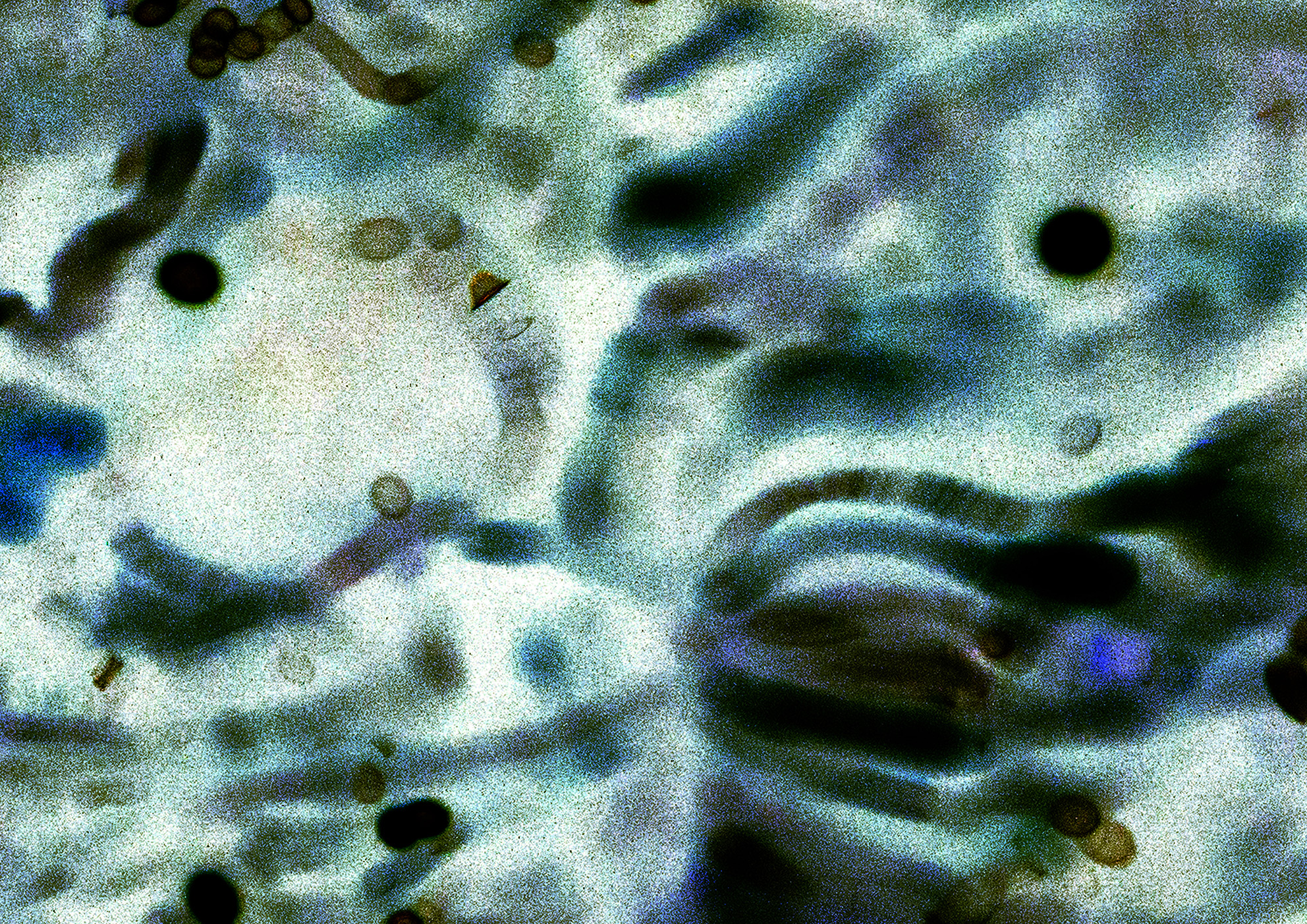 21A