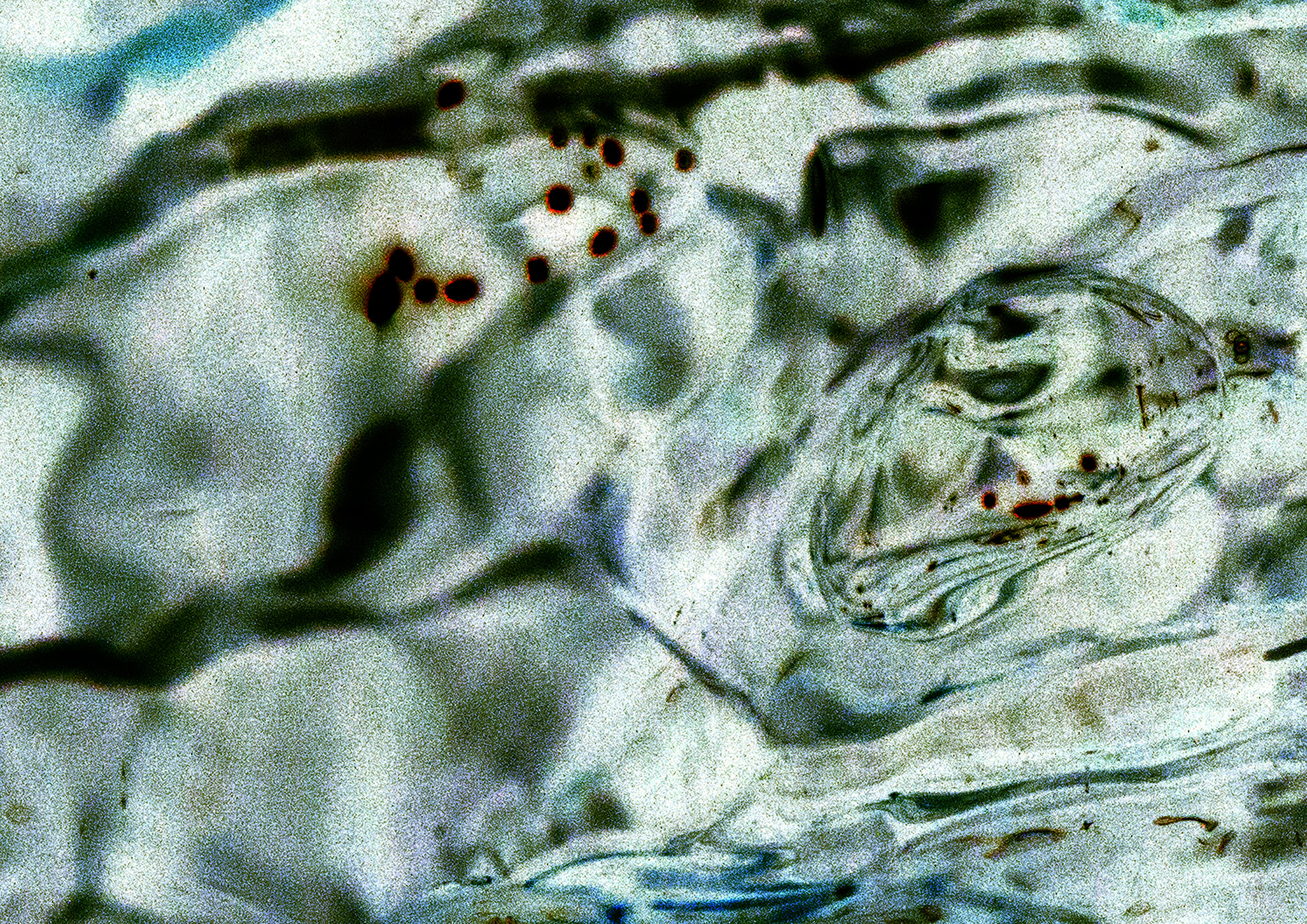 22A