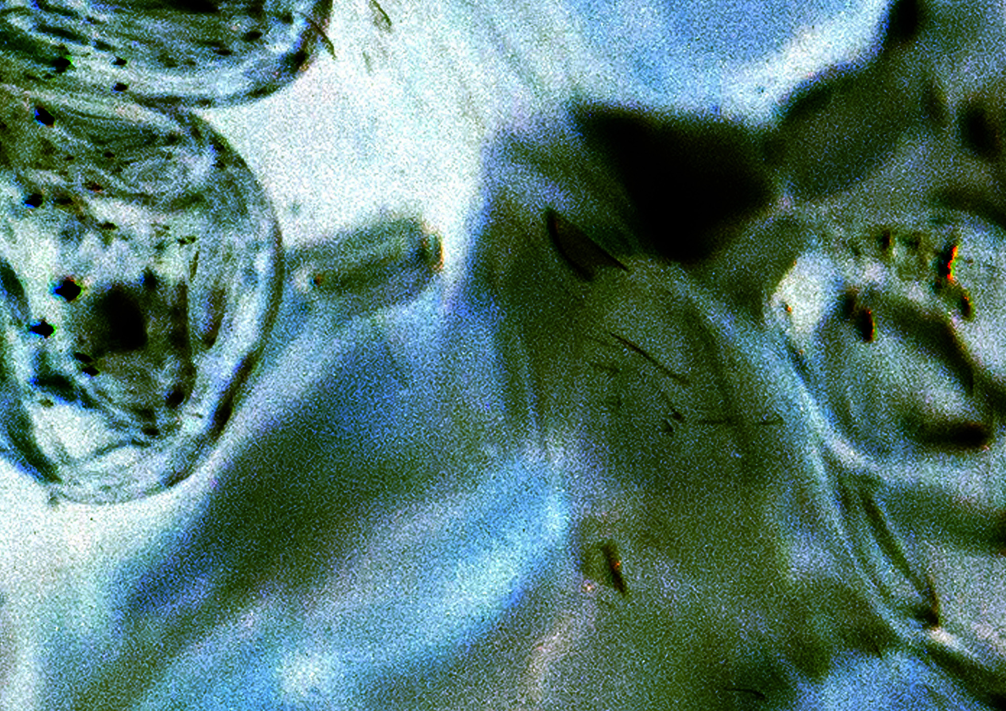 31a